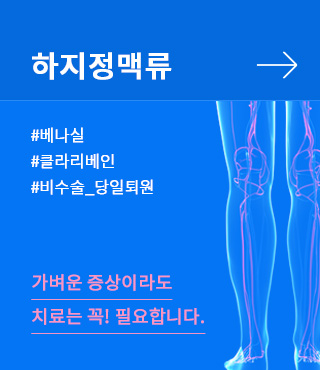 하지정맥류